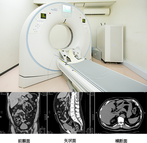 CT検査画像