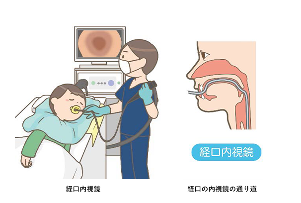 経口内視鏡