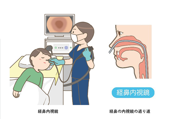 経鼻内視鏡